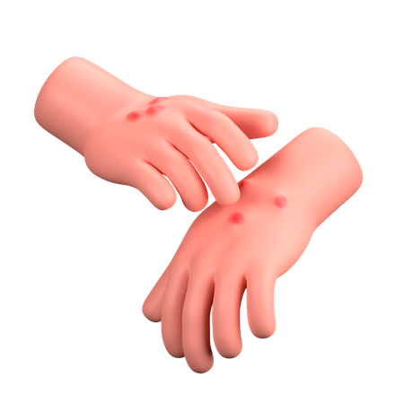 Allergy Test